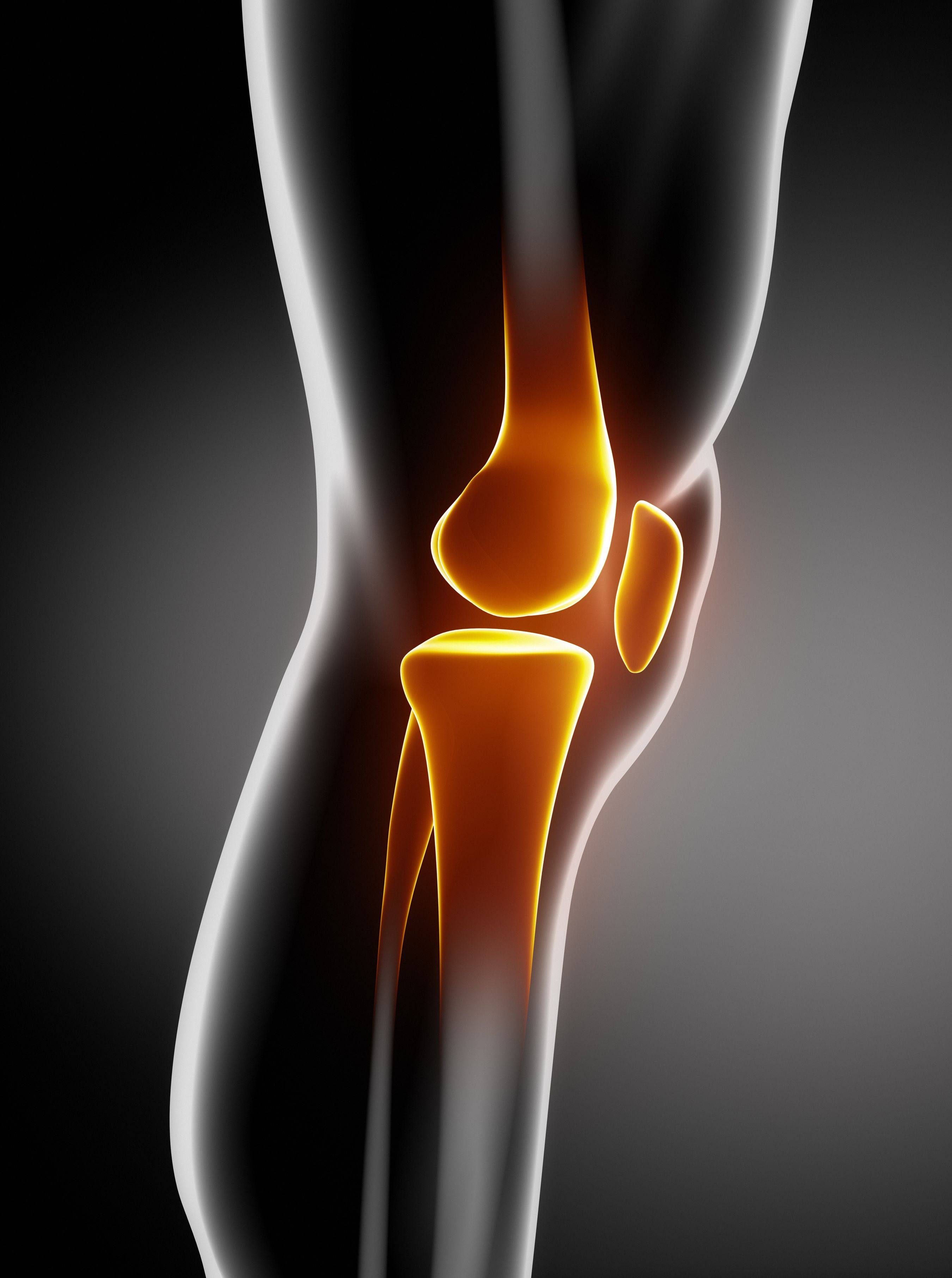 Manage Your Arthritis Pain with the Assistance of a Qualified Pain Physician