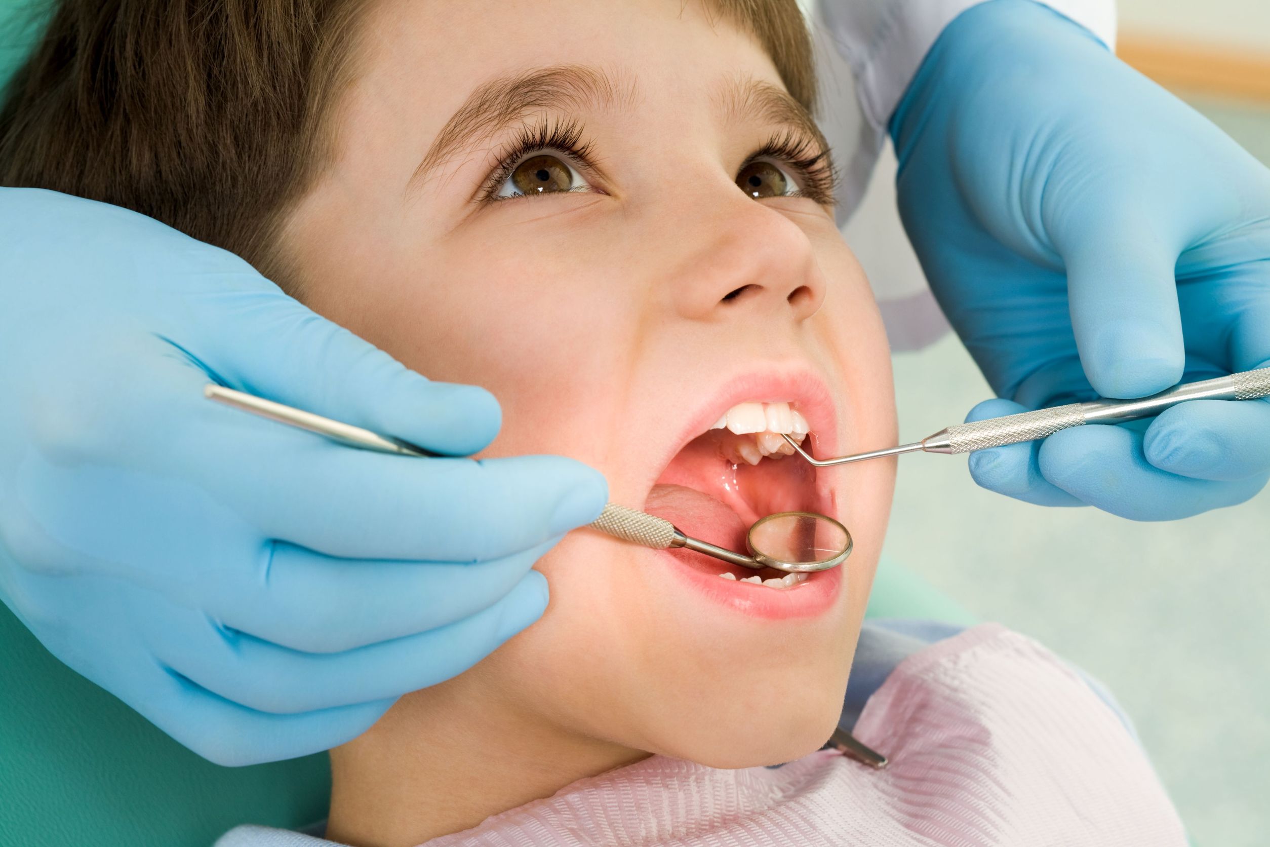 Do You Need Dental Root Planing in Nipomo, CA?